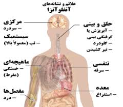 پاورپوینت بیماری آنفولانزا