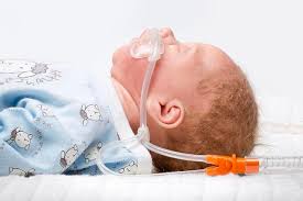 پاورپوینت سندروم دیسترس تنفسی در نوزادان (ppt) 24 اسلاید