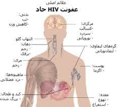 دانلود پاورپوینت تاریخچه بیماری  HIV AIDS