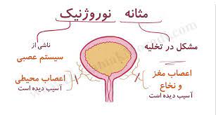 اسلاید آموزشی با عنوان مثانه نوروزنیک