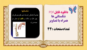 دانلود فایلPDF شکستگی ها همراه با تصاویر تعدادصفحات :44